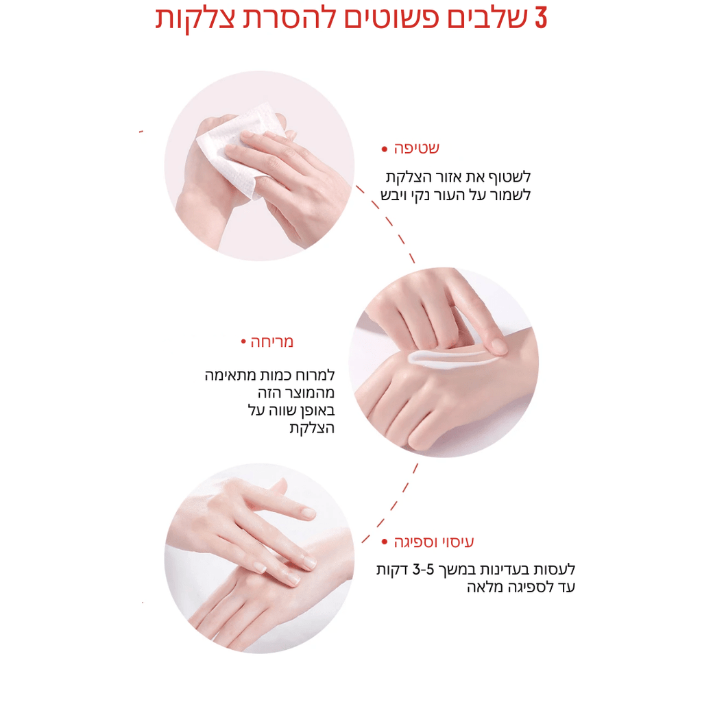 קרם להסרת צלקות – הטיפול המהפכני לשיקום העור שלך | קרם להסרת צלקות | אוזו - שופ